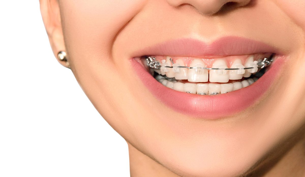 Teeth